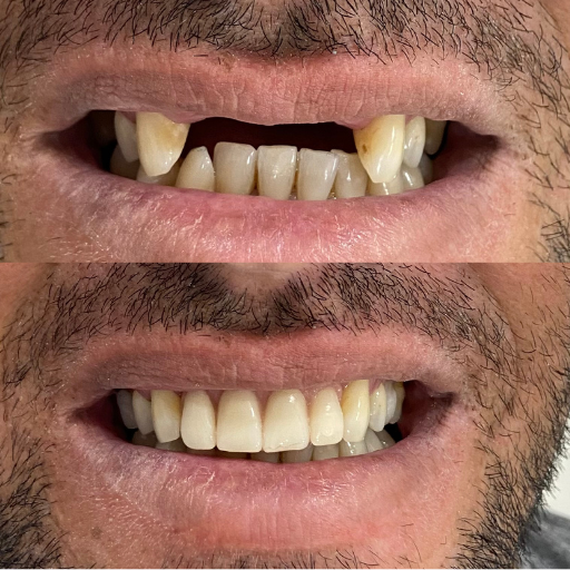 Antes e depois 4