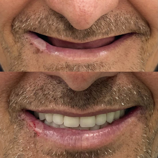 Antes e depois 5